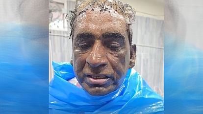 अबोहर में व्यक्ति ने खुद को लगाई आग: आप नेता मांग रहे आठ लाख रुपये, परेशान होकर किया आत्मदाह का प्रयास 53 year old man attempt to suicide in Abohar allegation on AAP leader they demanding Rs 8 lakh