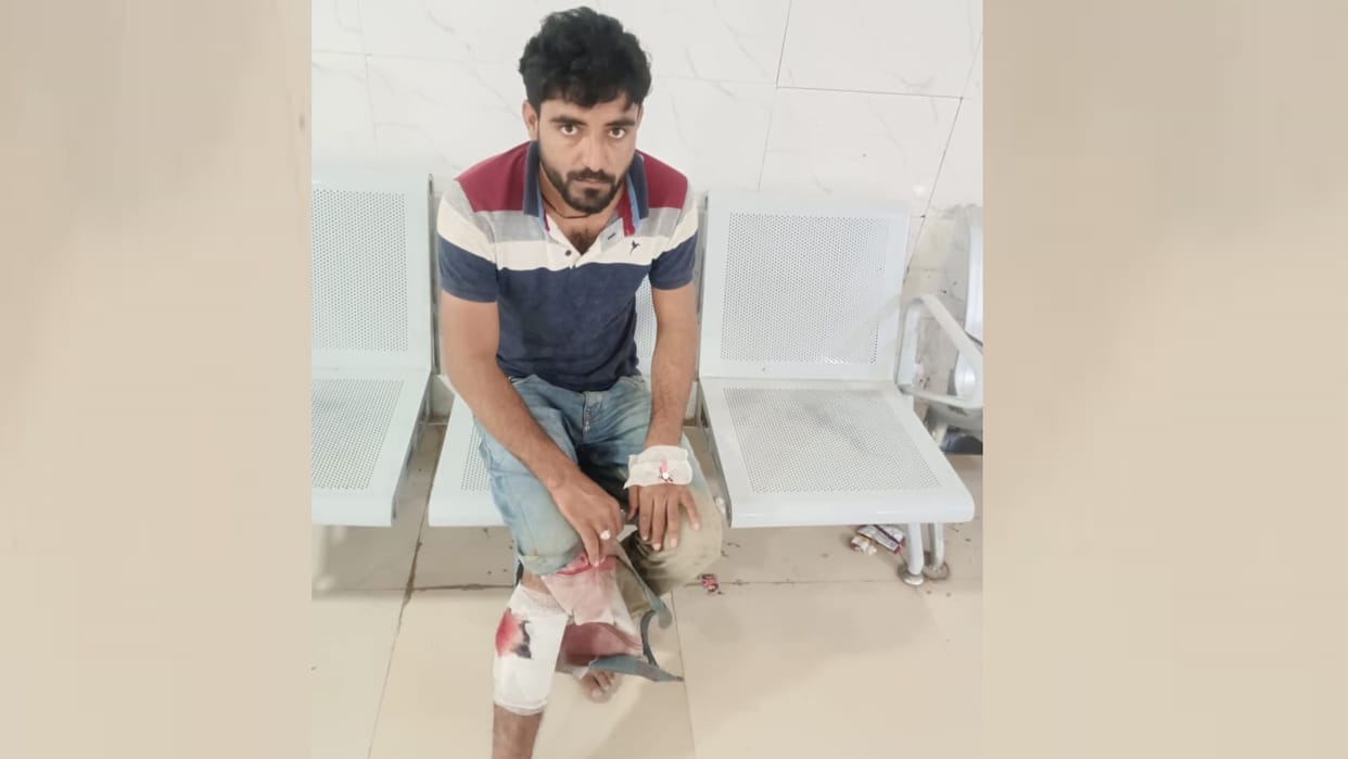 A cow smuggler got injured in an police encounter in Malihabad.