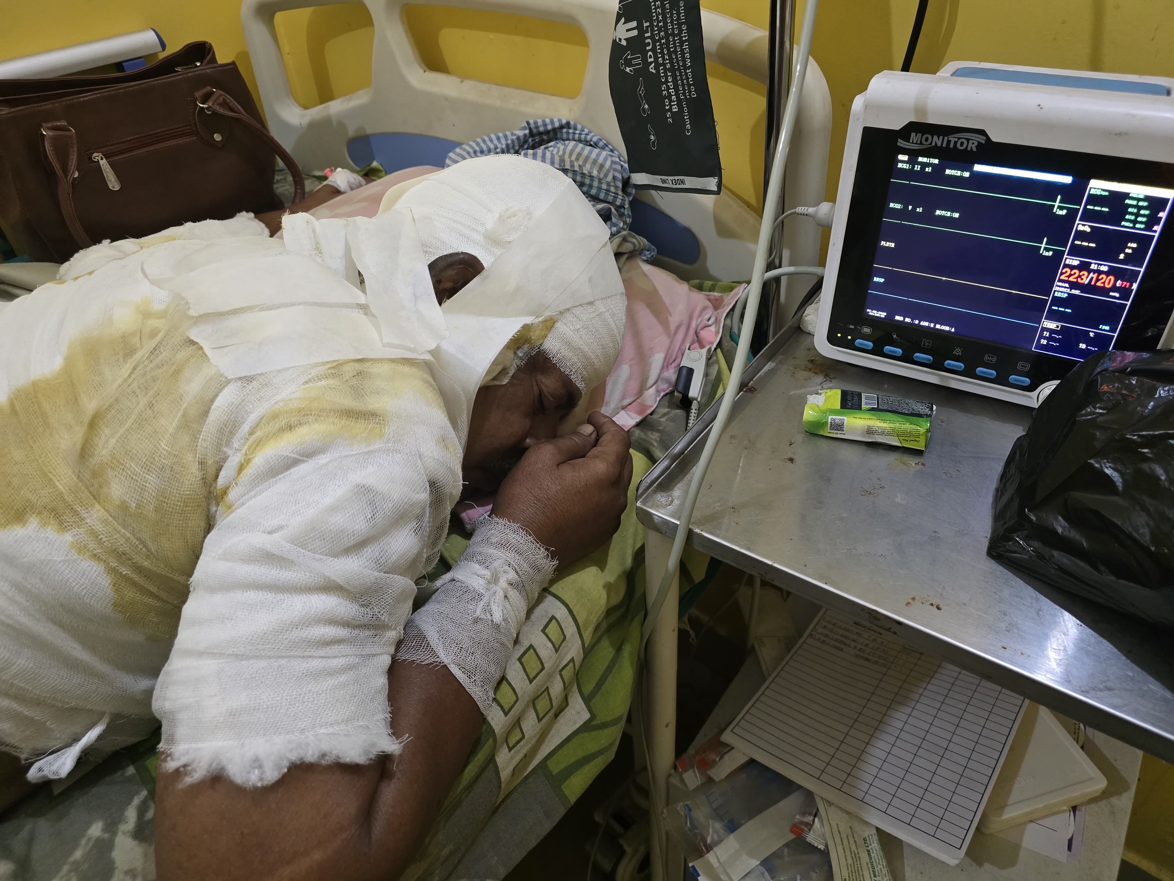 Bihar News: Attempt to kill a tea shopkeeper by burning him alive in Saharsa, condition critical; Bihar police