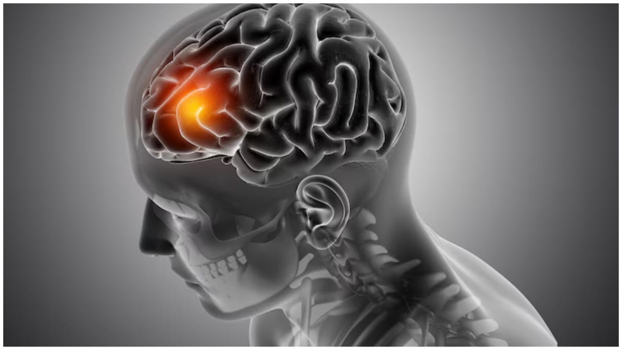 Winter Stroke Risks Signs of Stroke in Cold Weather and prevention tips in hindi