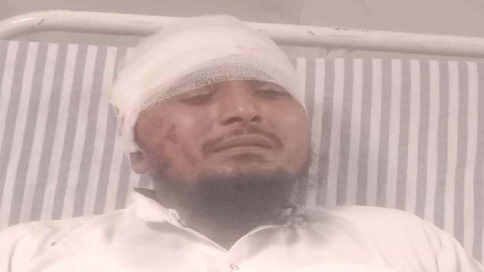 Meerut: Imam said to come to the mosque with clean clothes, angry youth shot him in the head with a pistol