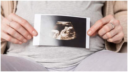 world first pregnancy using new STAR AI-guided sperm recovery method know details in hindi