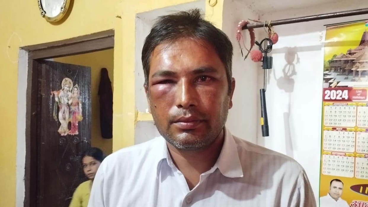 Kannauj: Doctors and staff beat up couple who had come to the medical college for their daughter's treatment