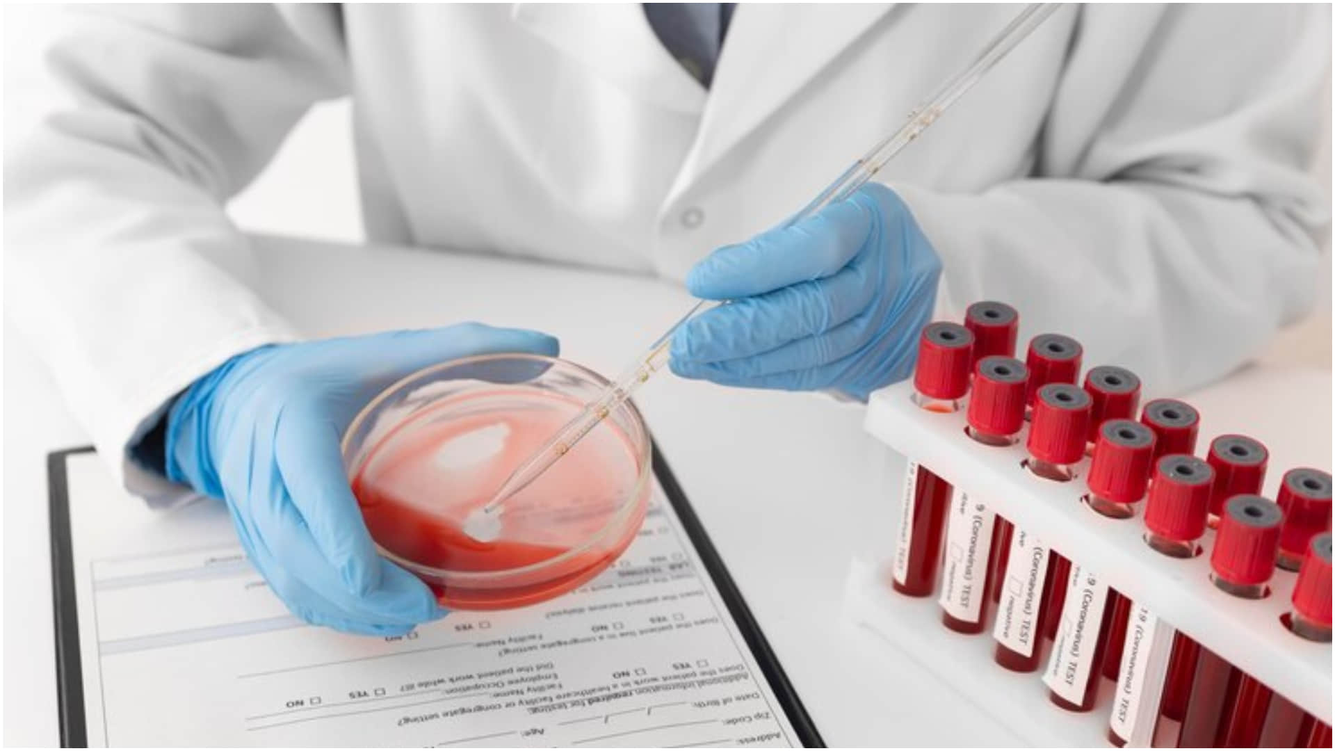 Every woman should get these 5 medical tests done after the age of 30 know in details