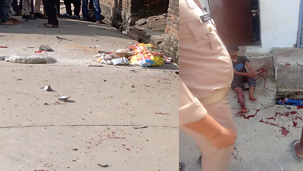Youth who came to India from Nepal to buy firecrackers got hit by firecrackers, injured