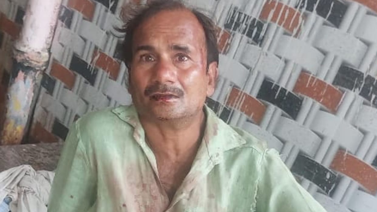 Two cases of enmity in Varanasi man and woman was beaten hockey and sword recovered FIR