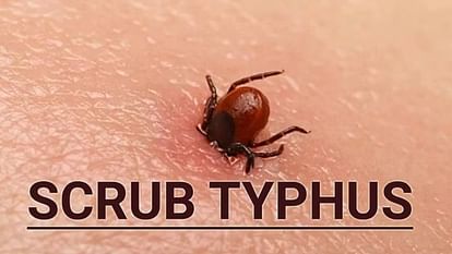 Himachal Scrub typhus hits Shimla 4 new cases reported know symptoms and prevention