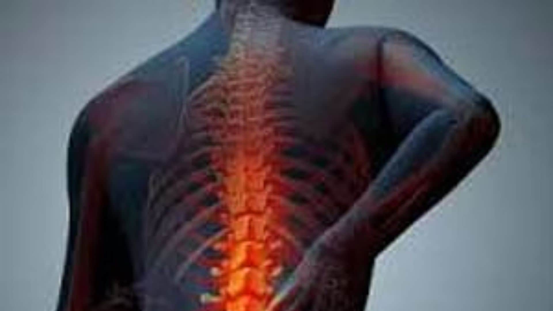 chronic neck or back pain risk what is Facet joint syndrome symptoms causes and treatments