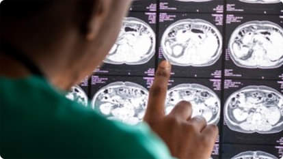 ब्रेन कैंसर का इलाज