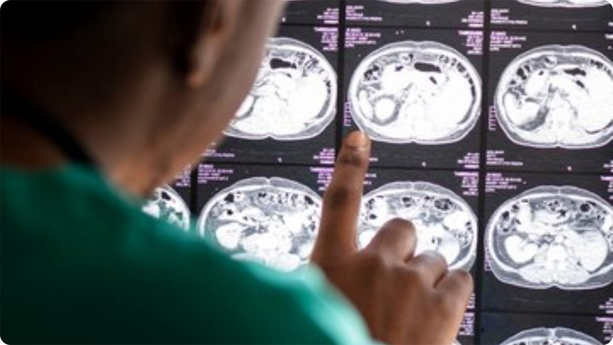 Russian scientists developed device for treatment of glioblastoma new hope for patients
