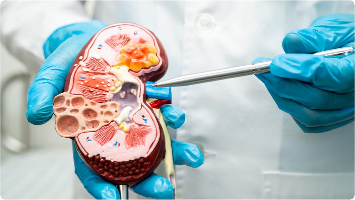 Kidney injury can cause hypertension know doctor advice for prevention and treatment