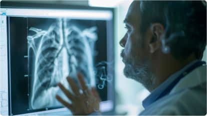 फेफड़ों की बीमारी- सीओपीडी