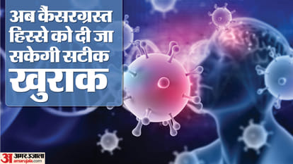UP: बड़ी सफलता... एआई बताएगा कैंसर के मरीजों को कितना चाहिए रेडिएशन; ऐसे काम करता है ये उपकरण AI will tell how much radiation cancer patients need