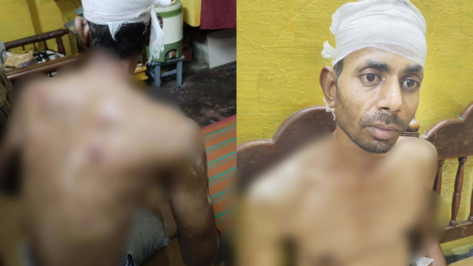मारपीट से घायल युवक