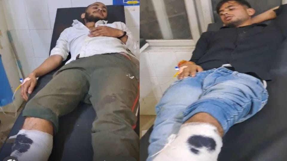 Police arrested two criminals during encounter who looted BJP leader in Mathura both injured by bullet shots
