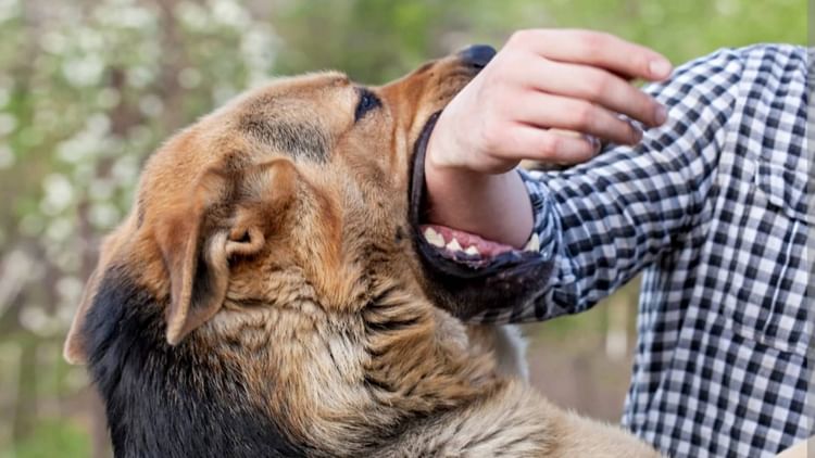 Dog Attack: कुत्ते के काटने से जख्मी व्यक्ति का भोपाल के अस्पताल में काटना पड़ा हाथ, डॉक्टर ने ये वजह बताई
