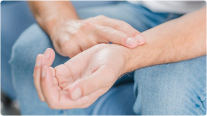 high cholesterol symptoms on hand and eyes you should look tendon xanthomata