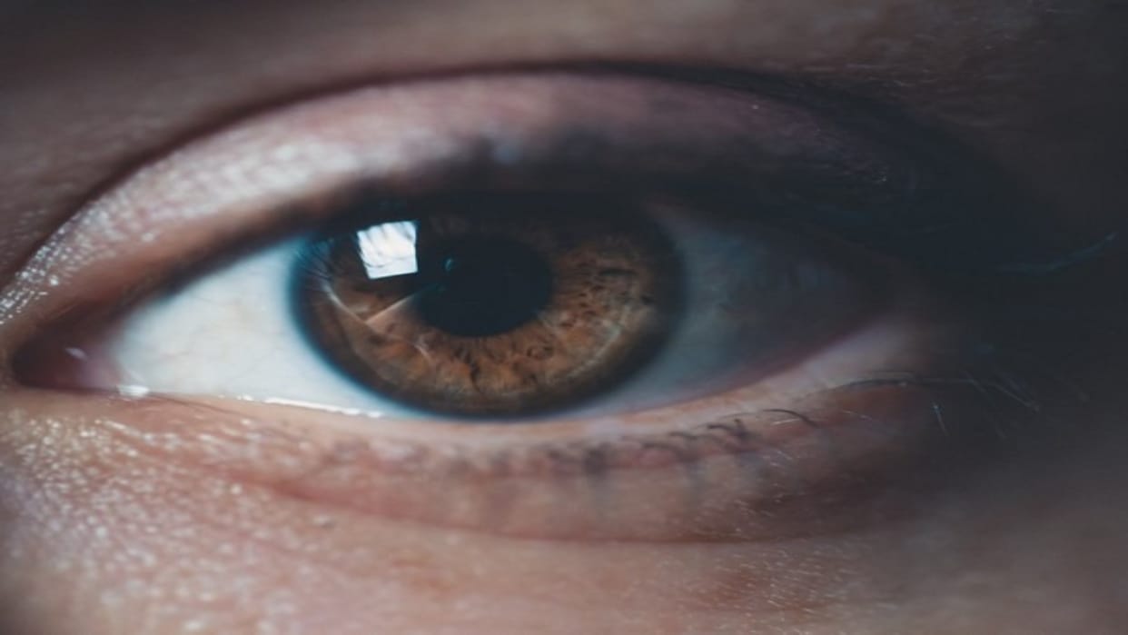 Cataracts are increasing in children due to injury genetics and disease in womb