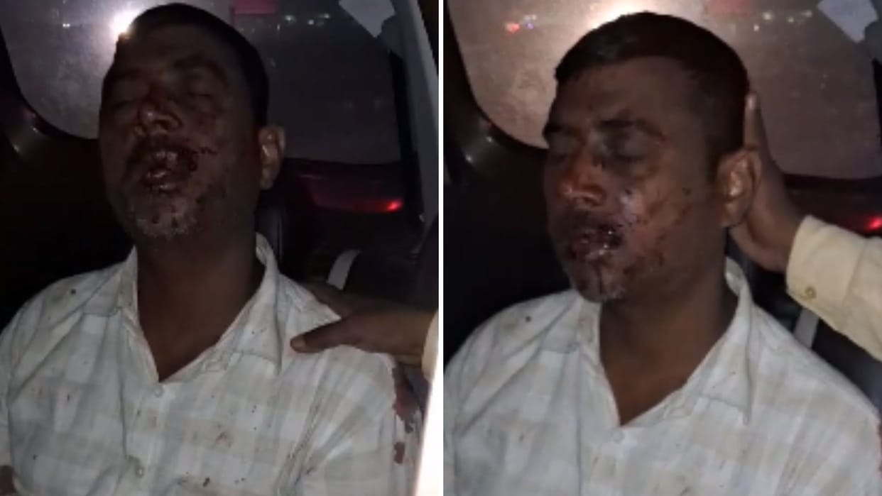 about three lakh rupees and three kg silver looted in jaunpur miscreants beat and committed crime