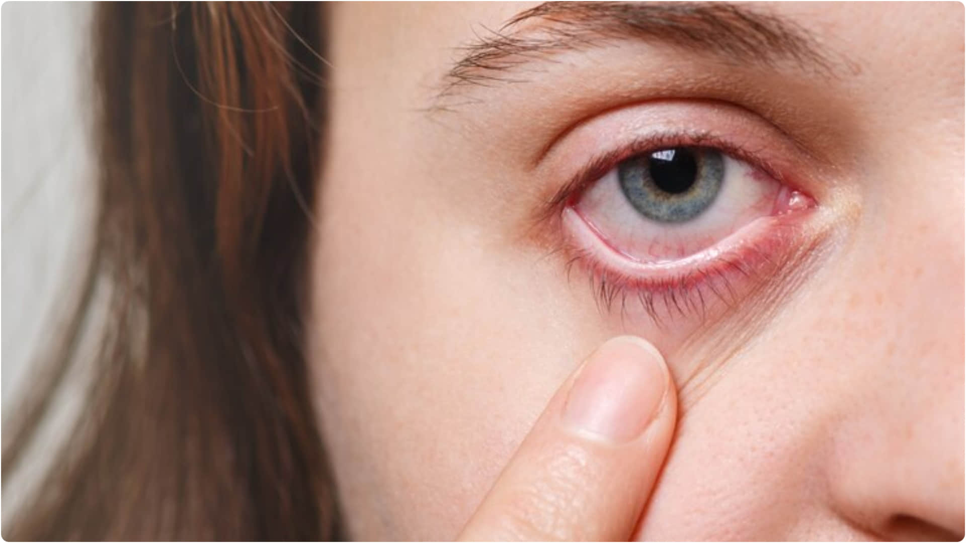high cholesterol causes heart disease symptoms of high cholesterol in eyes