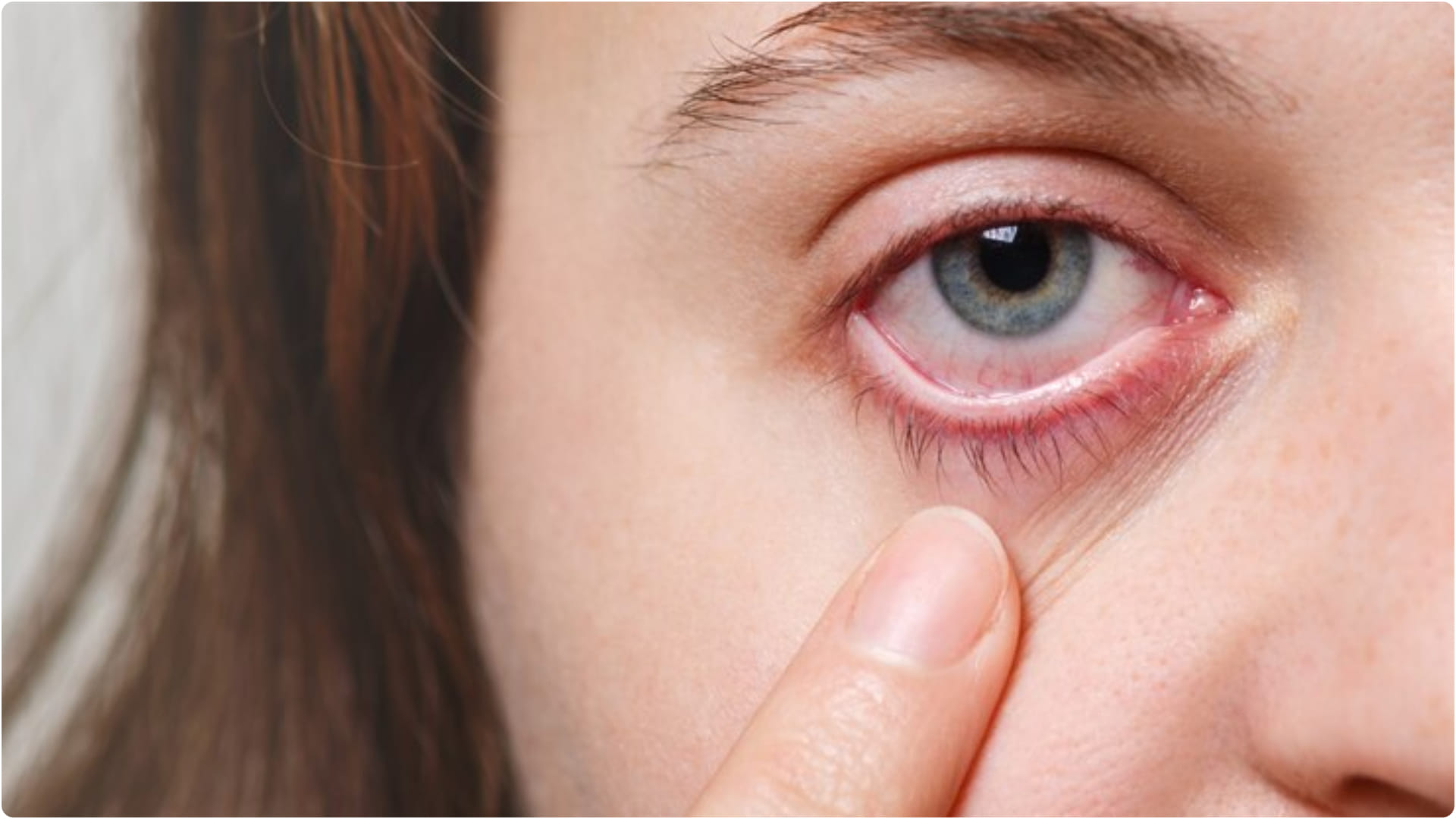 what habits affecting our eyes know bad habits for eyes health in hindi