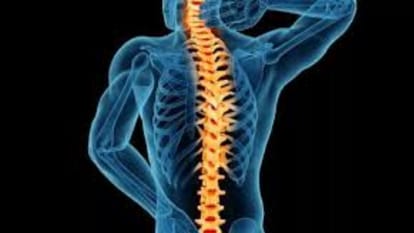 Cyst removed from spinal cord of 12 year old girl through operation