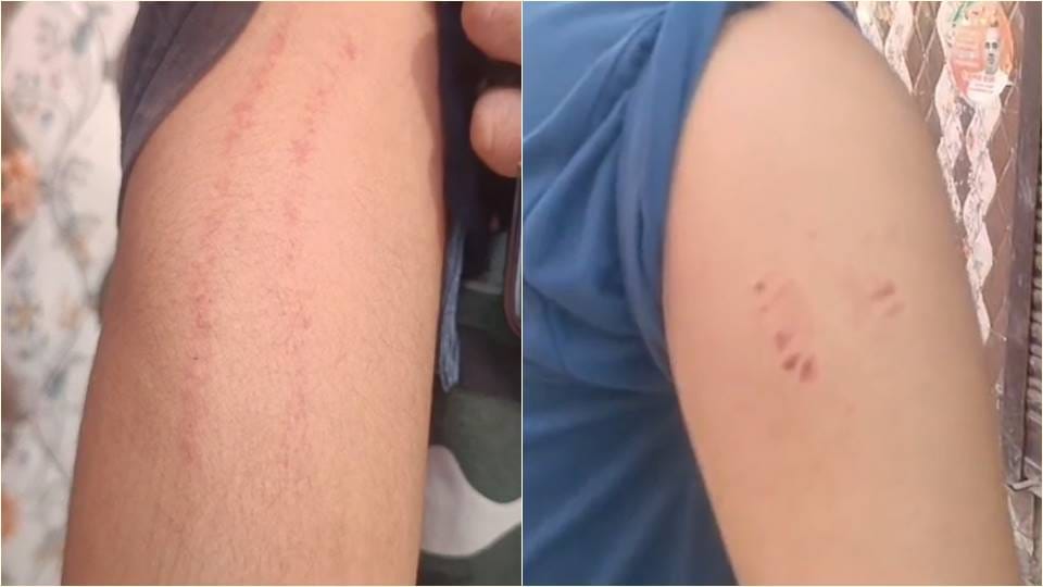 neighbours from other community entered house of a Hindu family and beat them up for bursting firecrackers In