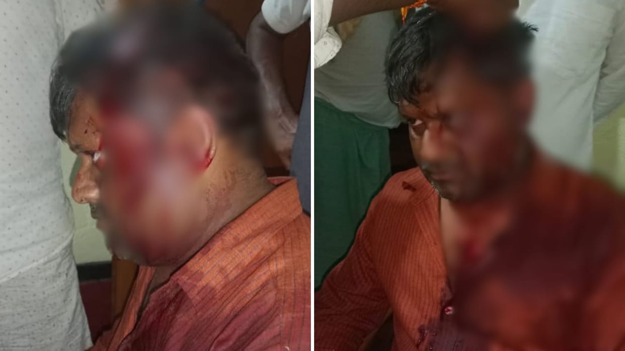 Burning firecracker thrown in veranda two parties fight refused young man bleeding two people in custody