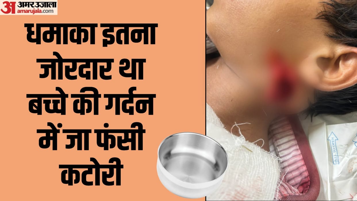 Explosion made by putting sulphur potash in a bowl vessel got stuck in the neck of child