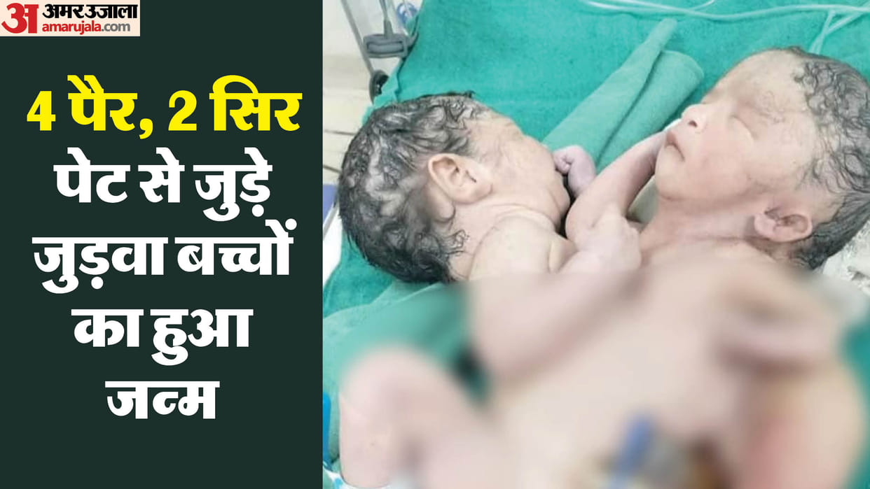 two brothers have one heart beating in their chest In Shahdol