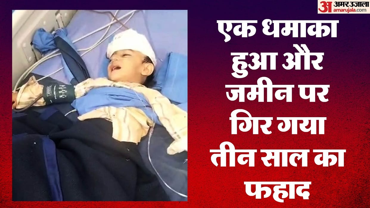 Bullet remained stuck in the head of an innocent child in Badaun for six days