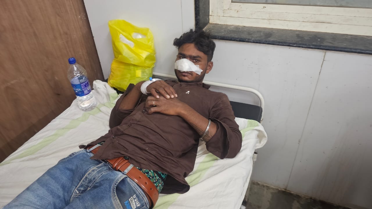 Chhatarpur: Controversy over pushing during Maunia dance, angry youths cut off artist's nose with their teeth.