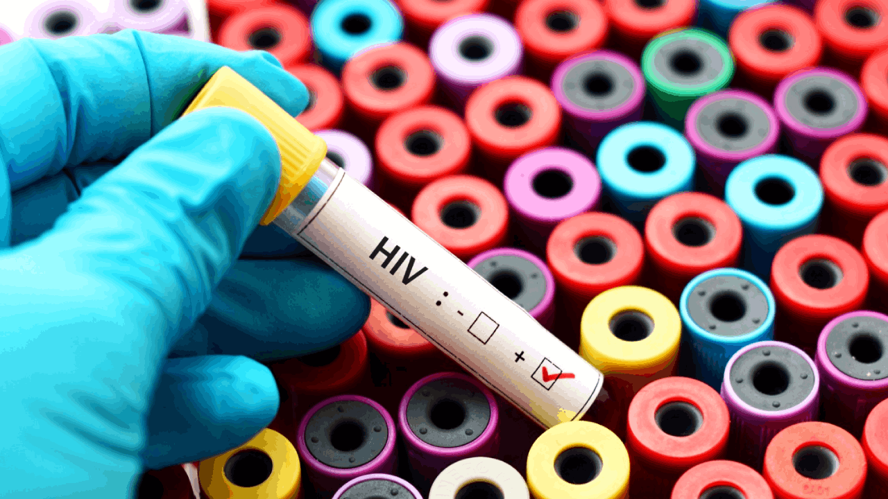 20 women became victims of HIV in four years due to tattooing