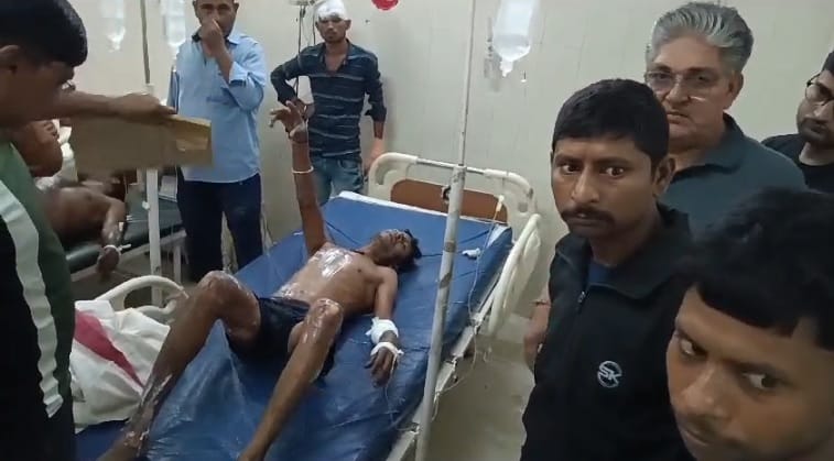 Three workers got scorched by hot water in a beer factory two in critical condition referred to Kanpur
