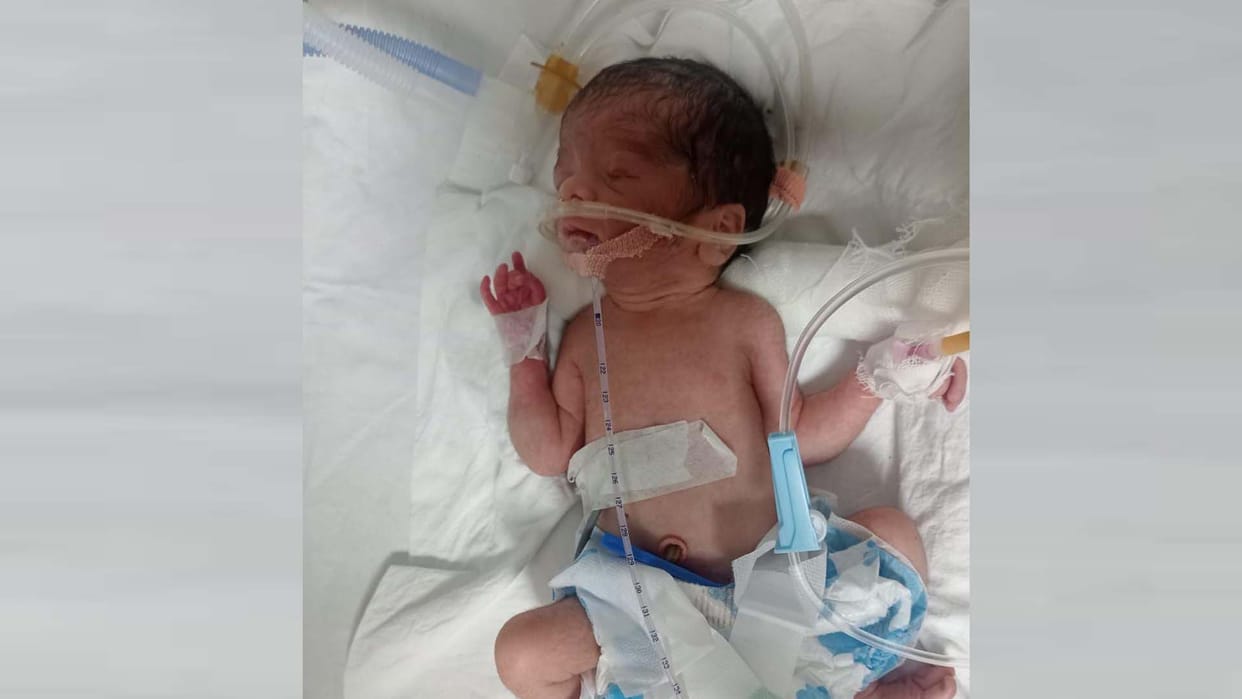 Kanpur: People thronged to adopt the baby girl found in the garbage