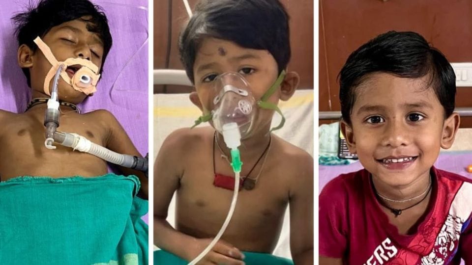 Doctors of Medical College Hospital Raigarh saved the life of a child bitten by a snake