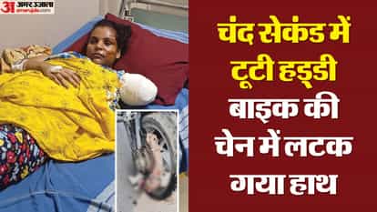 woman dupatta got stuck in the chain while she was riding bike her elbow got torn