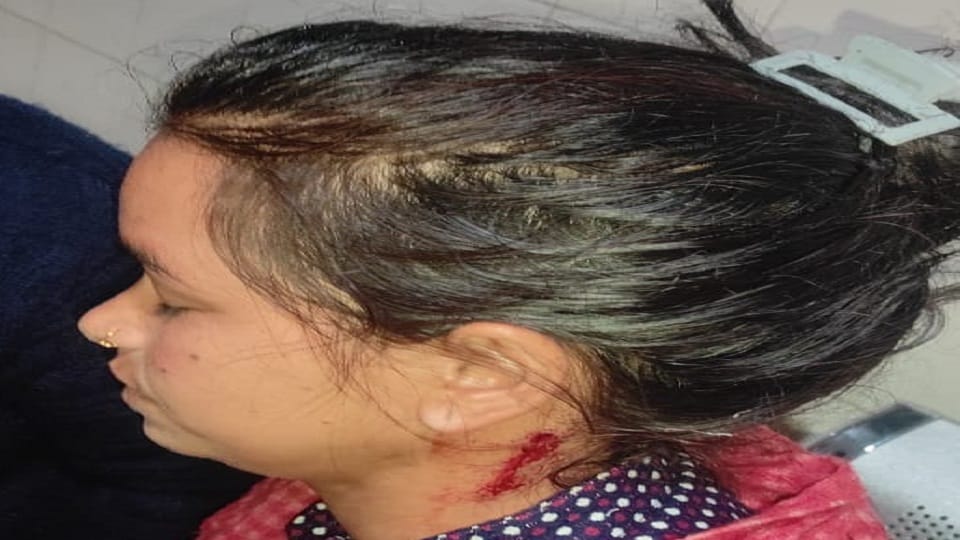 A bullet fired from an air gun to drive away monkeys hit a woman below her ear in bageshwar