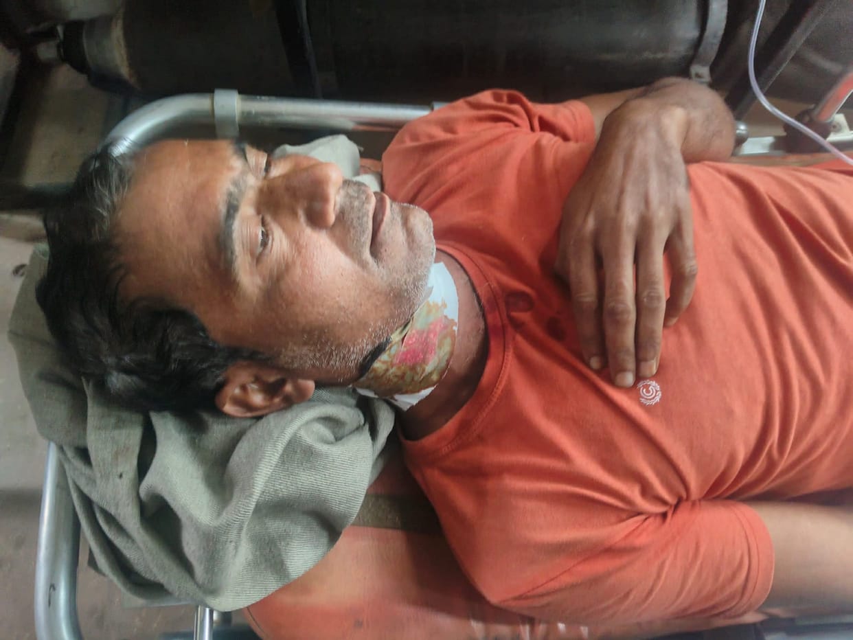 West UP News Live: PRS services will remain closed tonight, firing in Baghpat over dispute of garbage removal