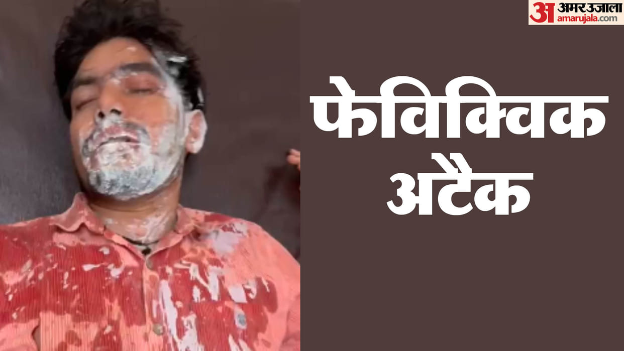 MP News Fevikwik Attack in Gwalior Youth Injured as Chemical Thrown on Face Madhya Pradesh News in Hindi
