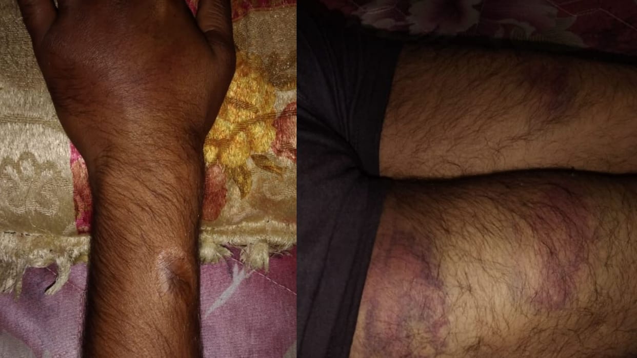 Lucknow: Youth accused of giving third degree for mobile theft, beaten with sticks.