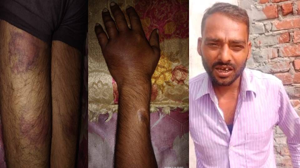 shuttering worker called to chowki and given third degree In Lucknow constable suspended inquiry ordered