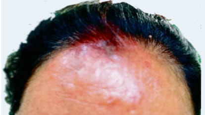 In Gorakhpur, businessmen have started adulterating vermillion, it is affecting the body.