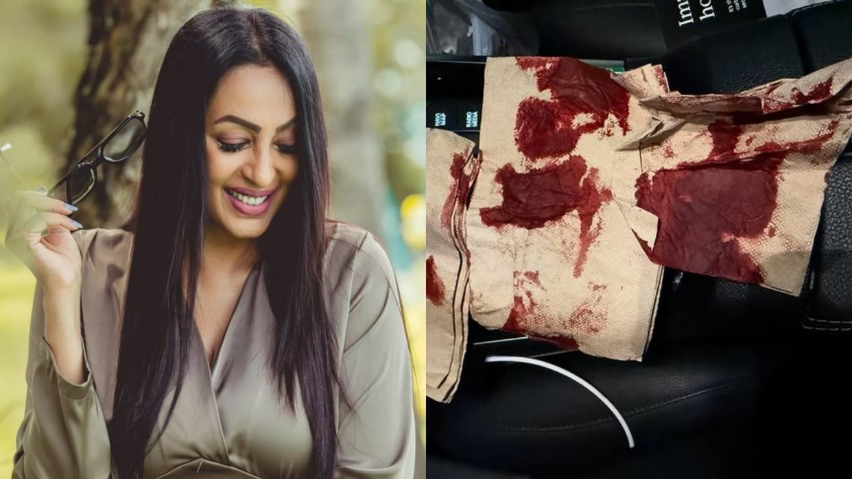 Kashmera Shah met with a freak accident today and she shared a picture of Blood soaked towel