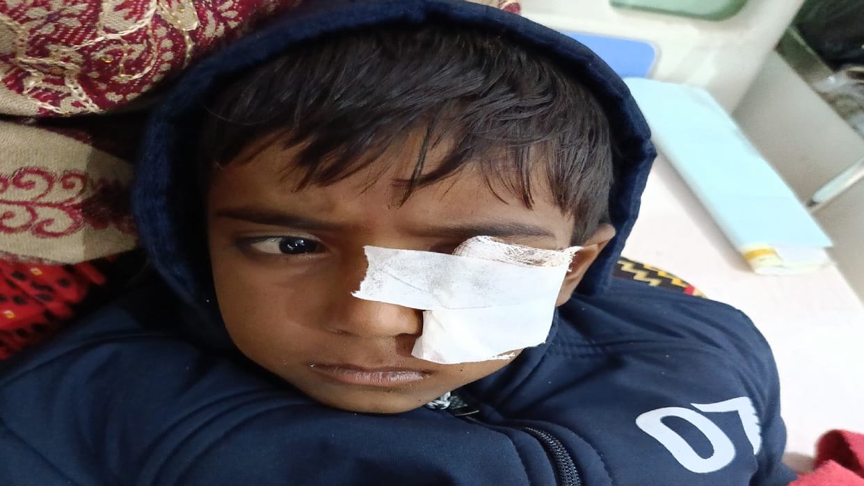 street dog attacked five-year-old child in bareilly
