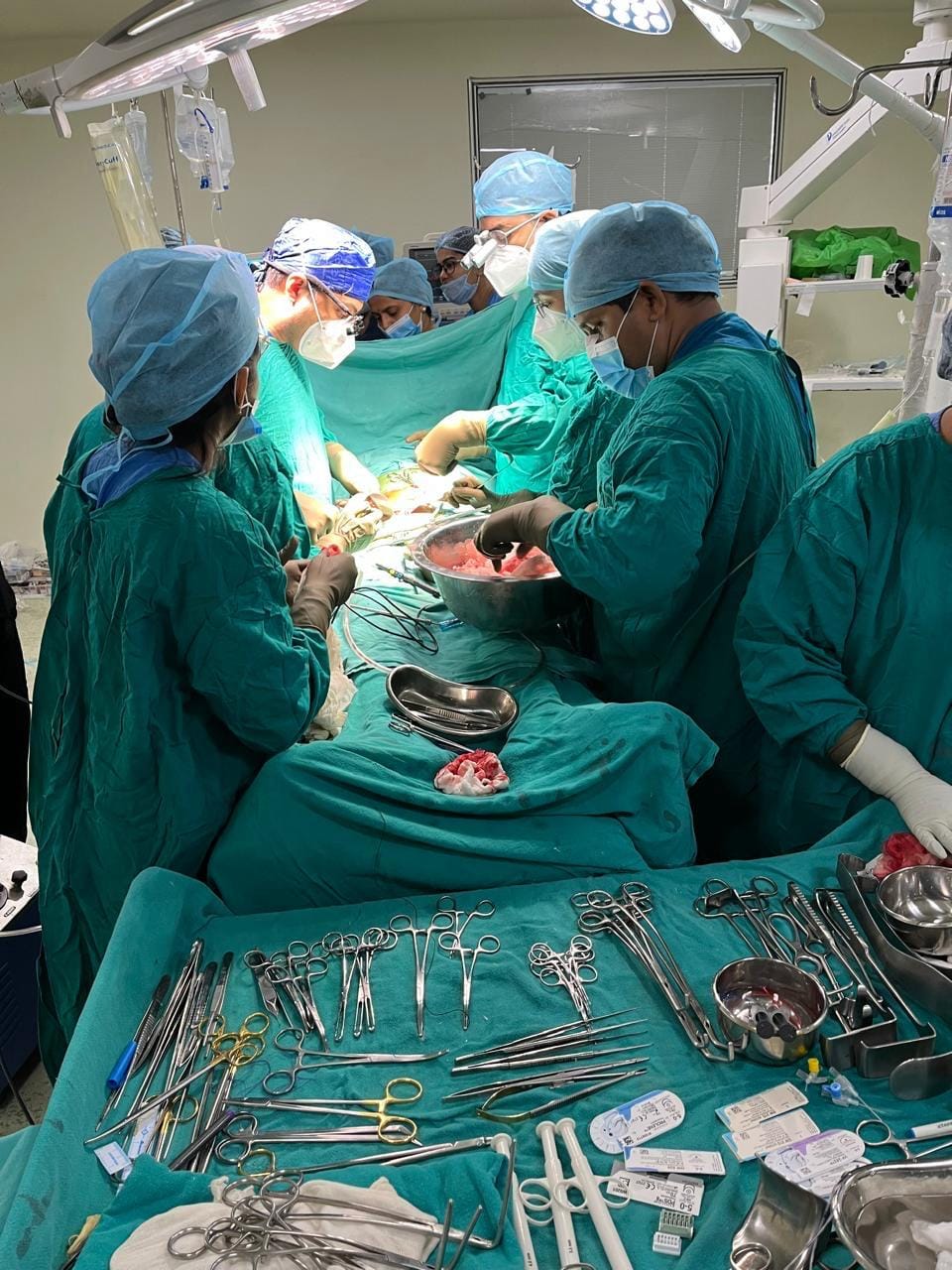 Bhopal: In Hamidia, a woman saved her husband's life by donating her kidney, a 49-year-old man underwent kidne