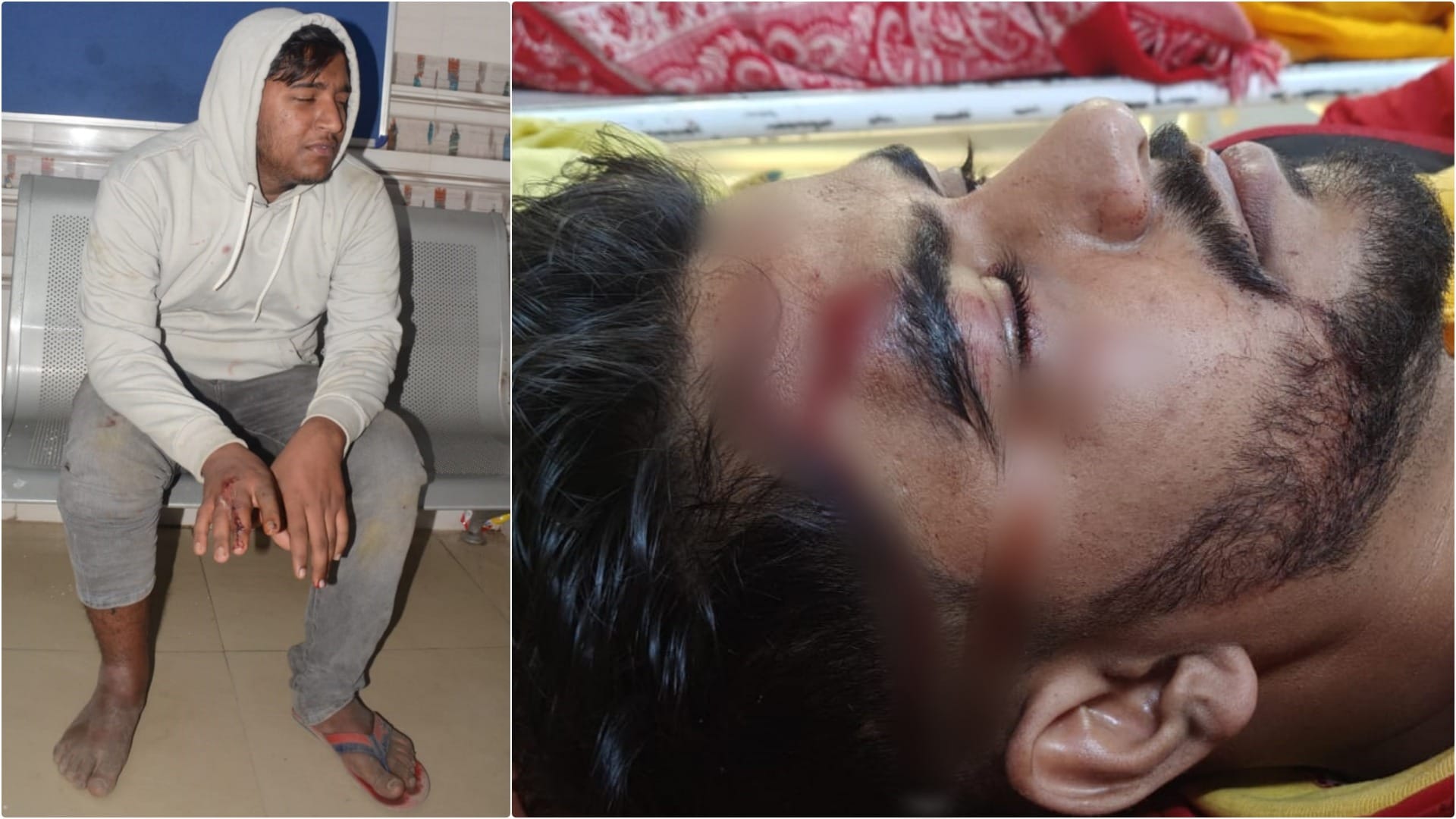 Bhagalpur News: Two groups of students clashed in ragging dispute, attacked police-administration, lathicharge