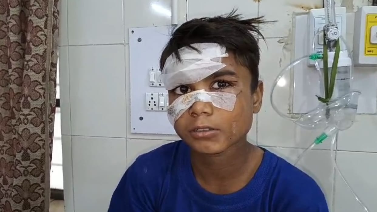 Dogs attack teenager in Bareilly's Sirauli