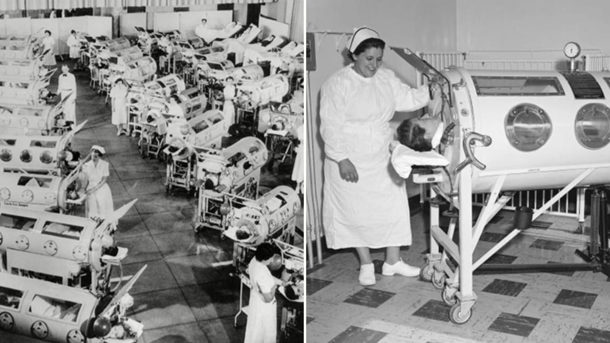 Paul Alexander 70 years live in iron lung the record is the Guinness World Book in hindi