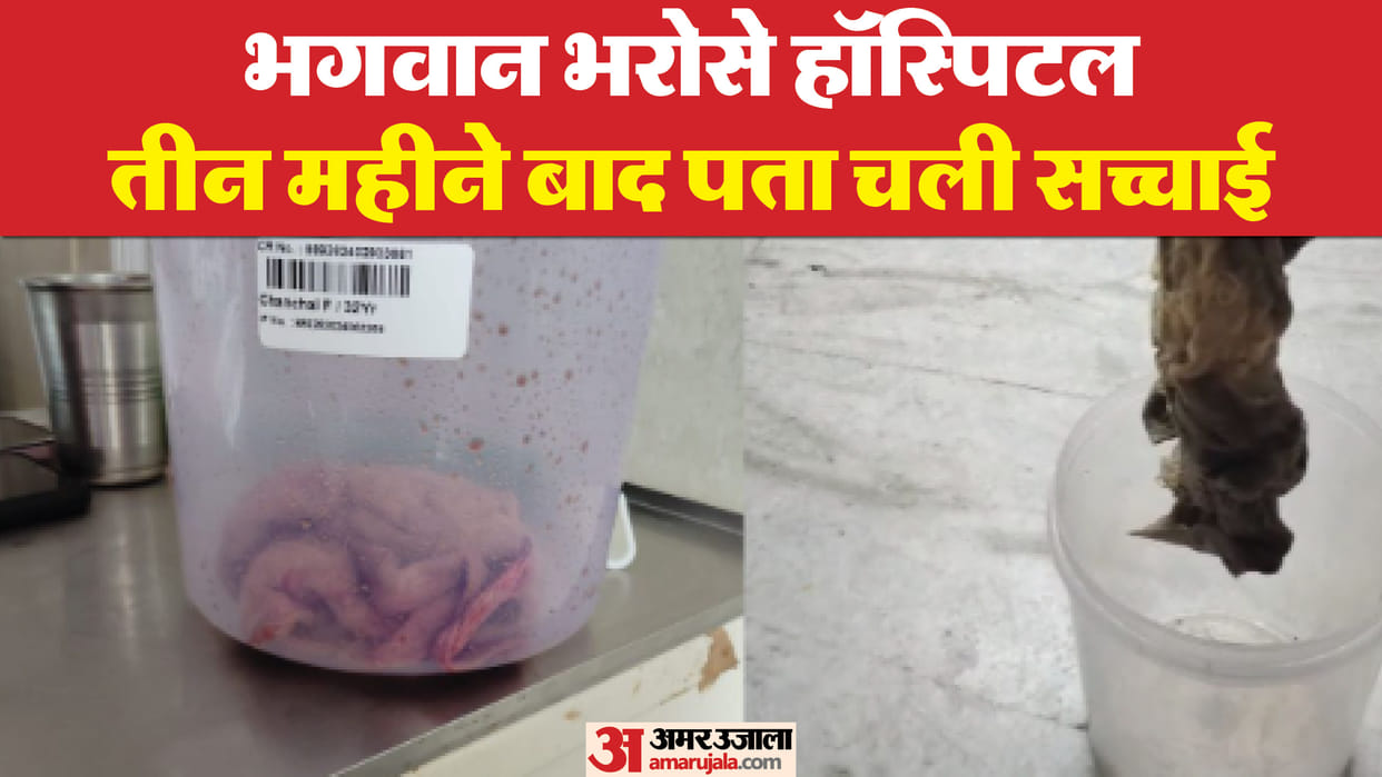 Jodhpur Crime News Doctor Left Towel inside Stomach During C Section Delivery Operation